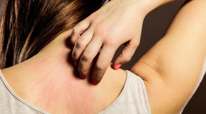 Аллергии: как распознать и жить полноценно с этой особенностью